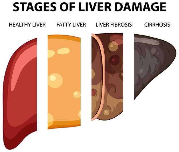 Metformin and end stage liver disease