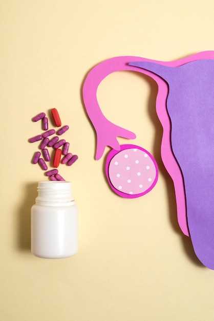 Metformin dose polycystic ovarian syndrome