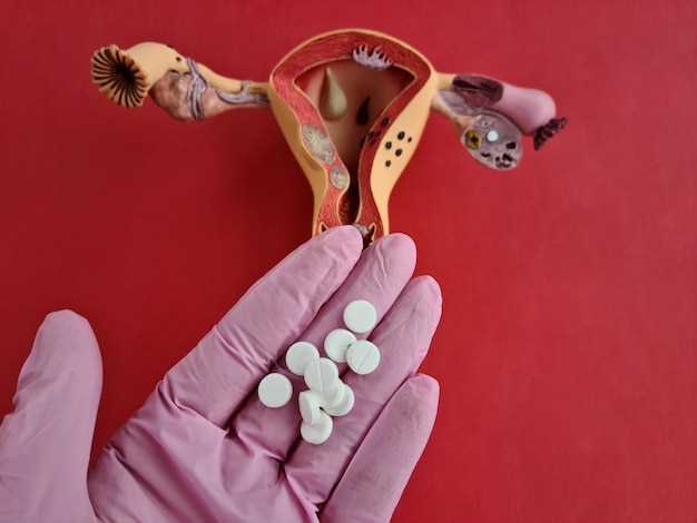 Metformin vs metformin extended release for pcos